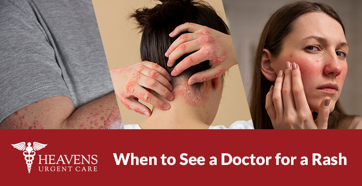 When to see a doctor for a rash