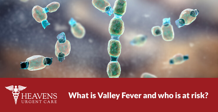 What is valley fever
