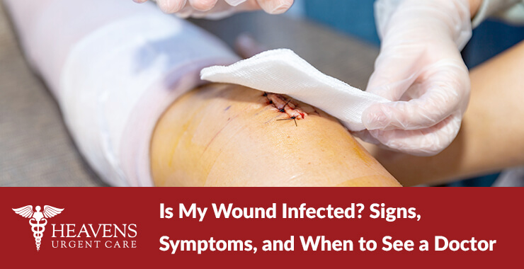 leg with stitched wound covered by gauze pad by doctor