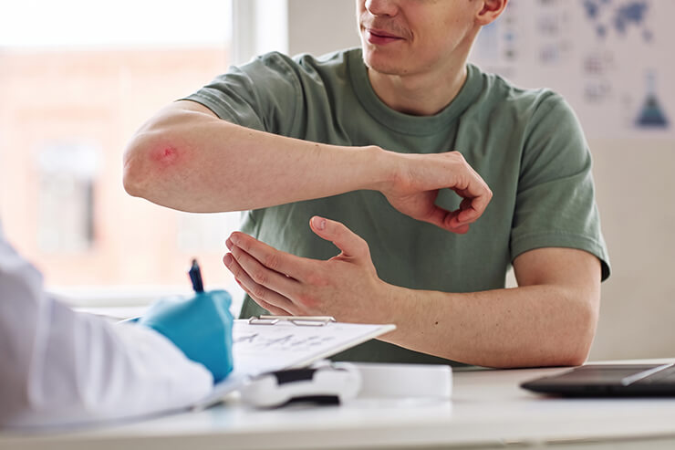 man showing doctor elobow with red skin around wound